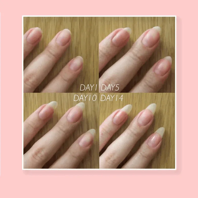 NAIL REPAIR PROTECTION GEL - Image 4
